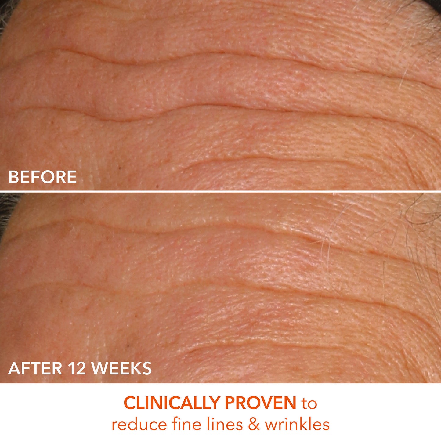 Dr. Dennis Gross Alpha Beta Universal Daily Peel - Image 11