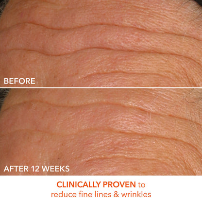 Dr. Dennis Gross Alpha Beta Universal Daily Peel - Image 11