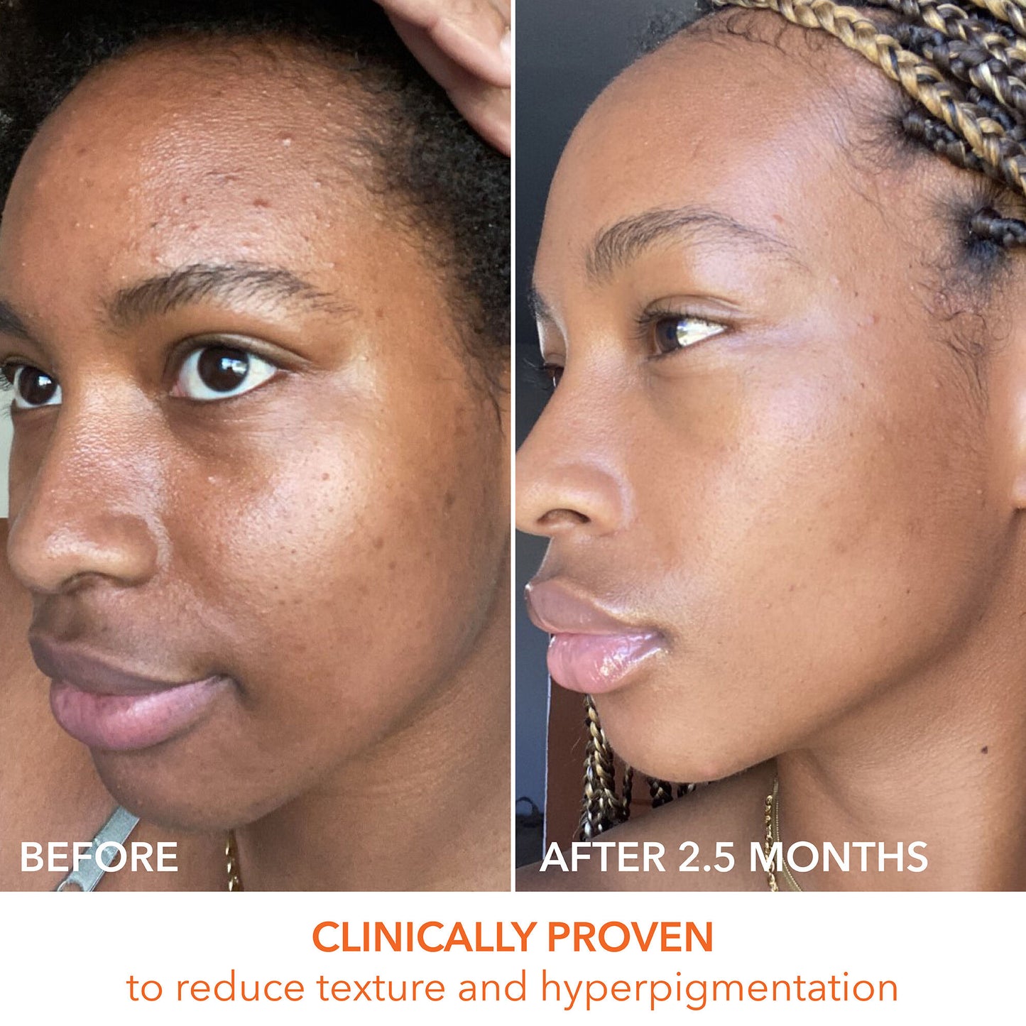 Dr. Dennis Gross Alpha Beta Universal Daily Peel - Image 10