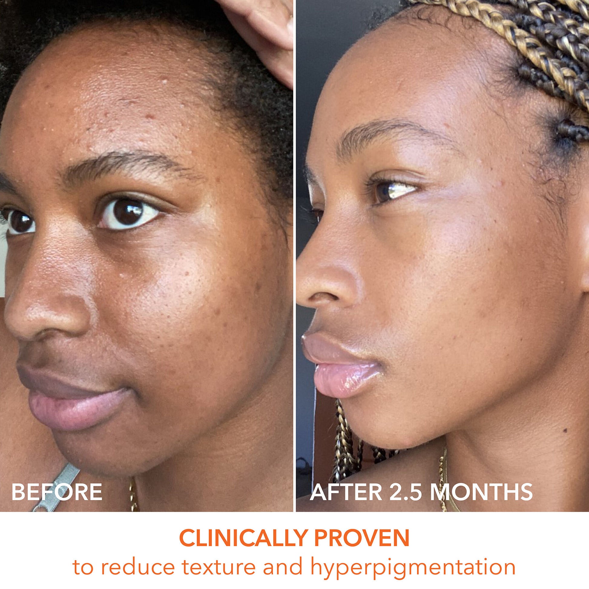 Dr. Dennis Gross Alpha Beta Universal Daily Peel - Image 10