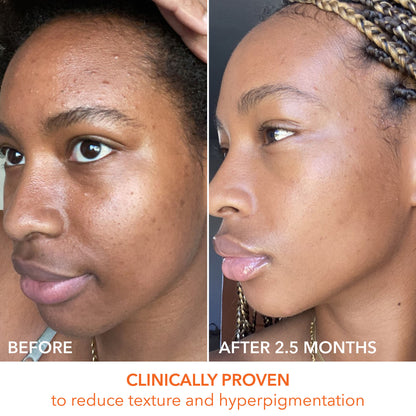 Dr. Dennis Gross Alpha Beta Universal Daily Peel - Image 10