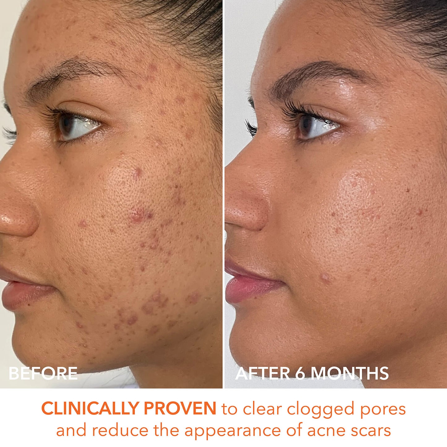 Dr. Dennis Gross Alpha Beta Peel Extra Strength Formula - Image 11