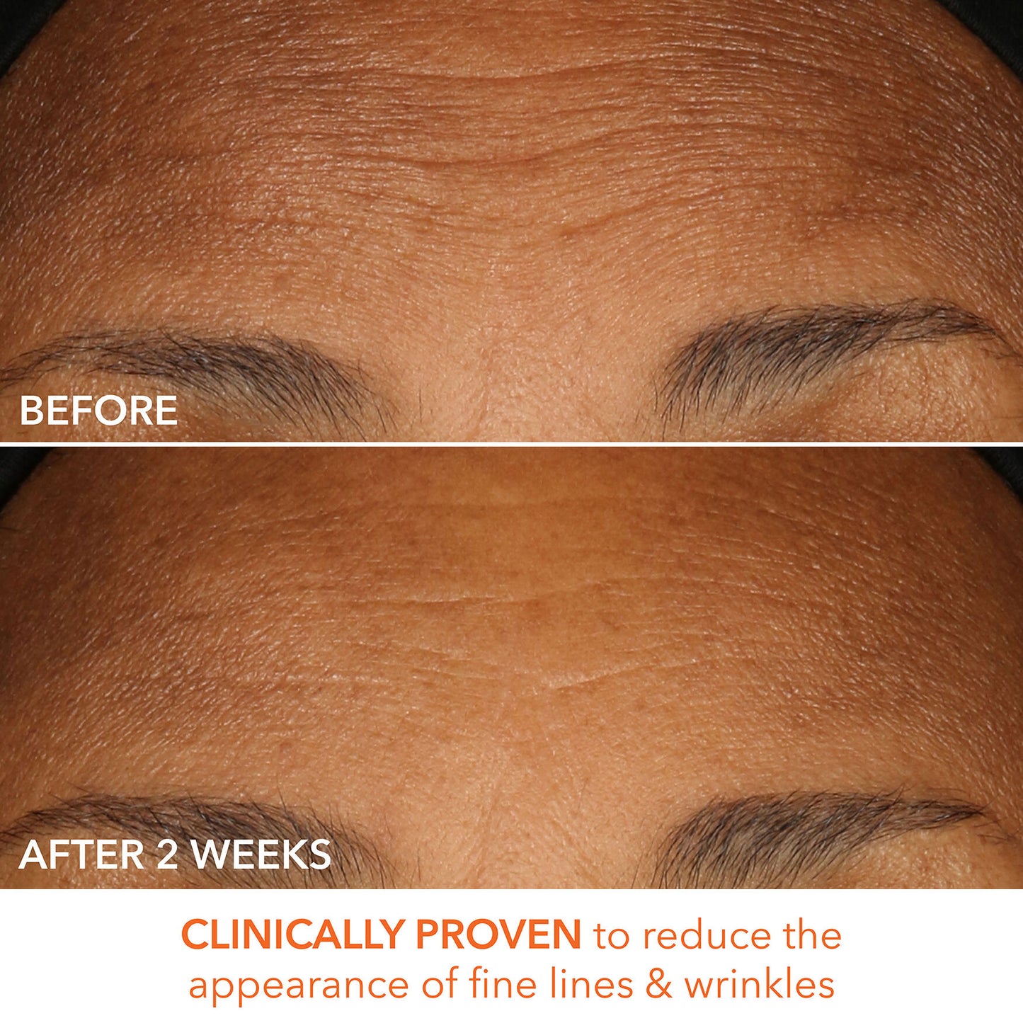 Dr. Dennis Gross Alpha Beta Peel Extra Strength Formula - Image 10