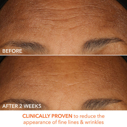 Dr. Dennis Gross Alpha Beta Peel Extra Strength Formula - Image 10