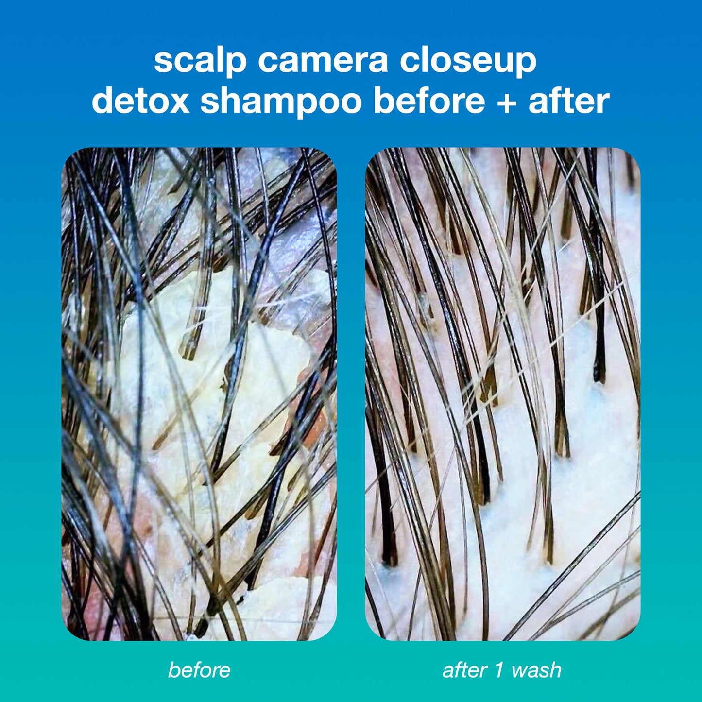 K18 HAIR Peptide PREP™ Detox Shampoo - Image 4