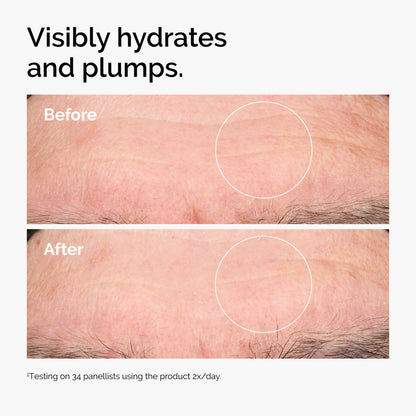 The Ordinary Hyaluronic Acid 2% + B5 - Image 4