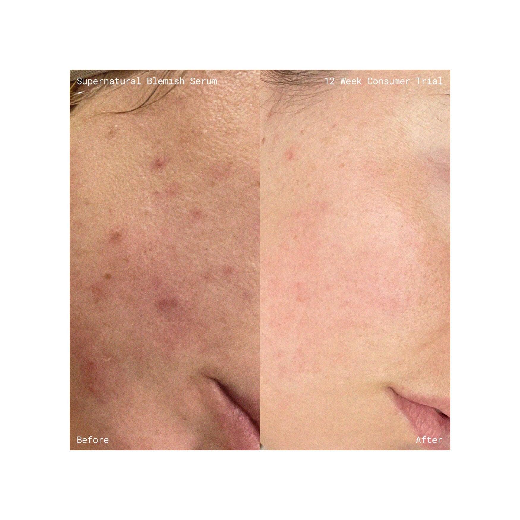 Emma Lewisham Supernatural Blemish Face Serum - Image 8
