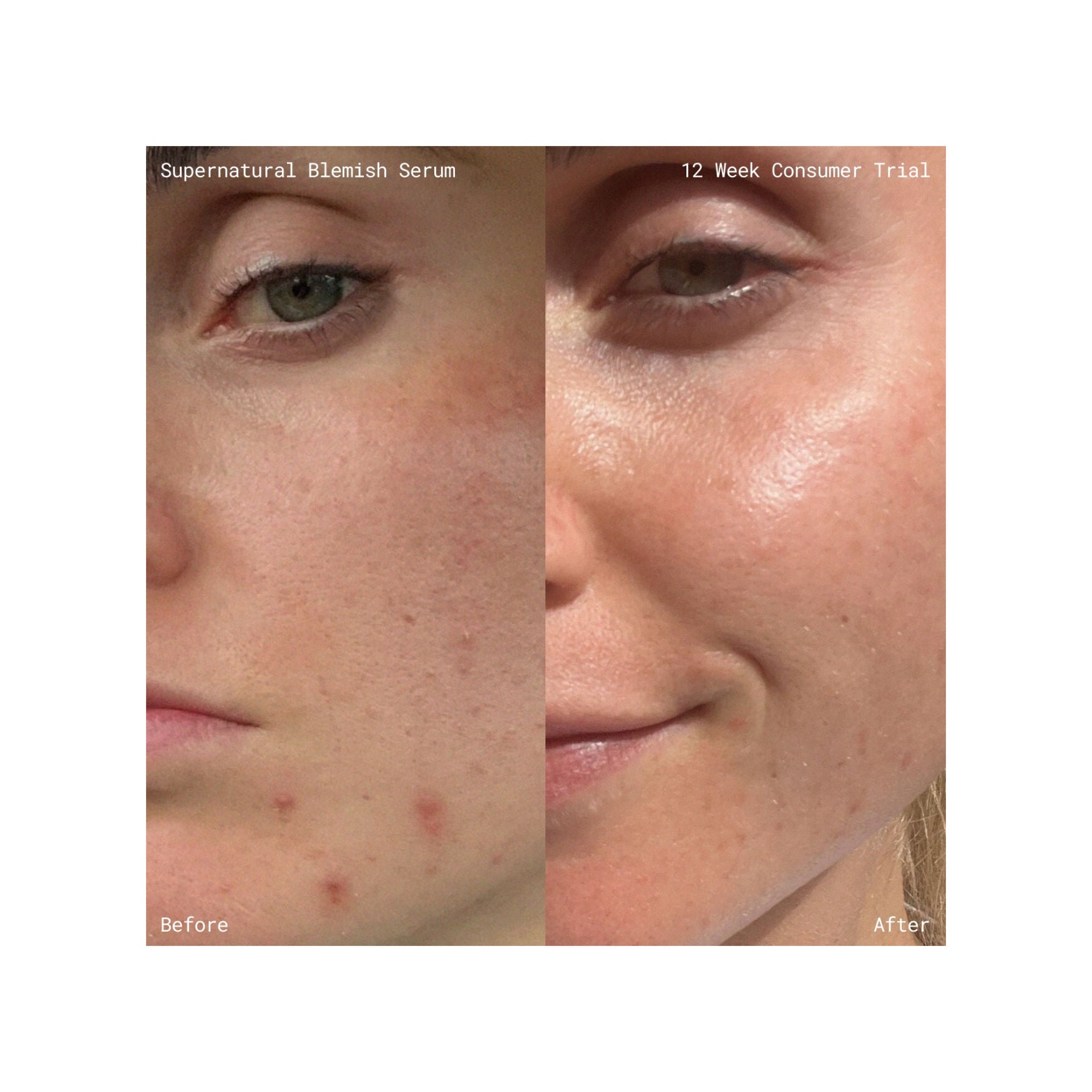 Emma Lewisham Supernatural Blemish Face Serum - Image 10