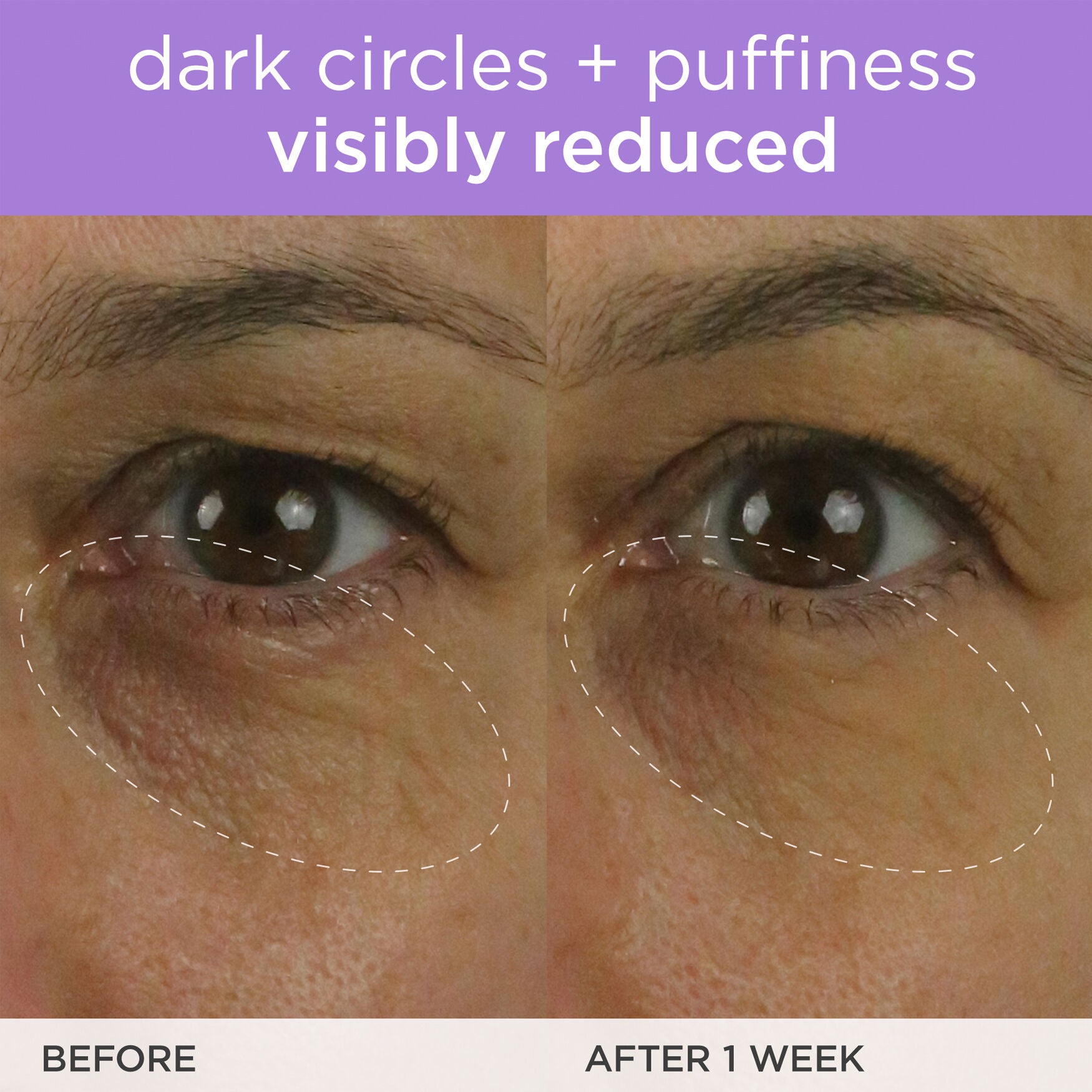 Tatcha The Brightening Eye Cream - Image 9