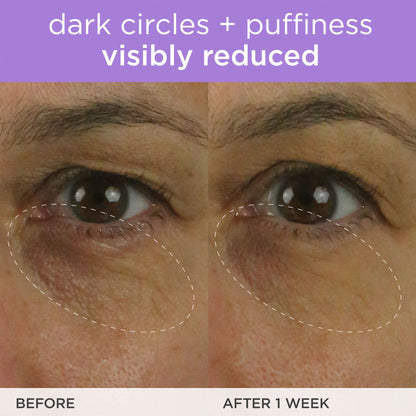 Tatcha The Brightening Eye Cream - Image 9