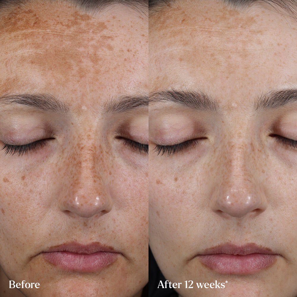 Skin Rocks The Hyperpigmentation Serum - Application