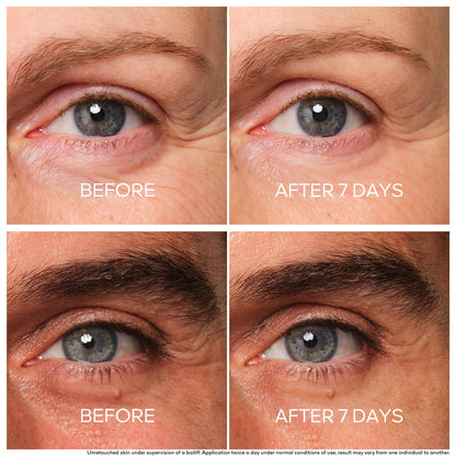 GUERLAIN Abeille Royale Youth Repair Eye Care - Product Details
