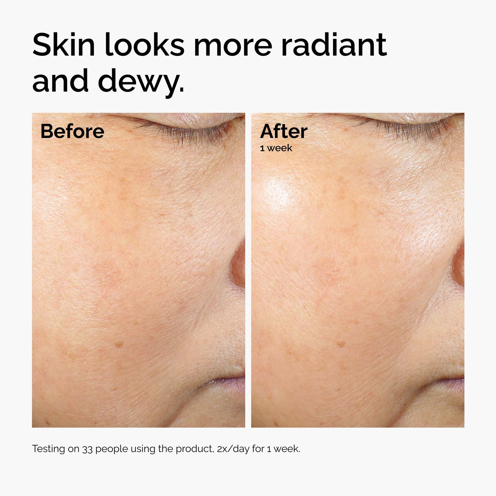 The Ordinary Brighten & Hydrate Bundle - Image 10