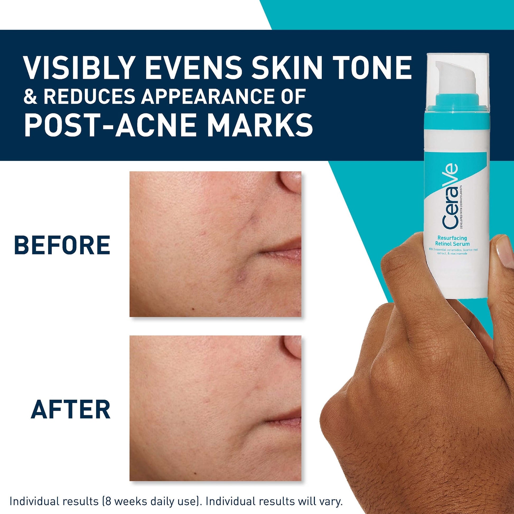 CeraVe Resurfacing Retinol Serum - Image 4