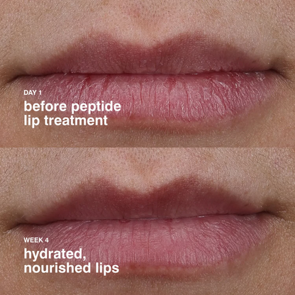 rhode Peptide Lip Treatment Nourishing Glaze - Image 4